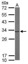 Anti-Proteasome 20S alpha 1 antibody [N1C3] used in Western Blot (WB). GTX104373