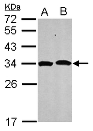 Anti-Proteasome 20S alpha 1 antibody [N1C3] used in Western Blot (WB). GTX104373