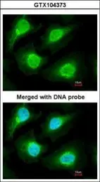 Anti-Proteasome 20S alpha 1 antibody [N1C3] used in Immunocytochemistry/ Immunofluorescence (ICC/IF). GTX104373