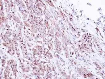 Anti-Proteasome 20S alpha 1 antibody [N1C3] used in IHC (Paraffin sections) (IHC-P). GTX104373