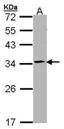 Anti-Proteasome 20S alpha 1 antibody [N1C3] used in Western Blot (WB). GTX104373
