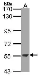 Anti-ENTPD3 antibody [N3C3] used in Western Blot (WB). GTX104376