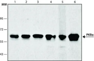 Anti-AKT1 antibody [PKB-175] used in Western Blot (WB). GTX10438
