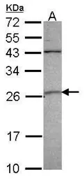 Anti-GSTA4 antibody [N1C3] used in Western Blot (WB). GTX104390
