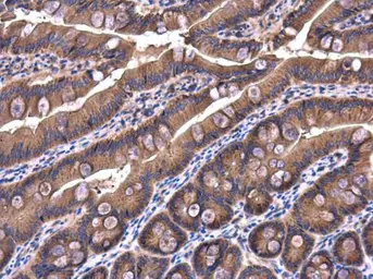 Anti-IRAK1BP1 antibody [N1C3] used in IHC (Paraffin sections) (IHC-P). GTX104392