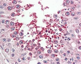 Anti-IRAK1BP1 antibody [N1C3] used in IHC (Paraffin sections) (IHC-P). GTX104392