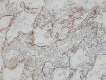 Anti-CLIC3 antibody [N1C3] used in IHC (Paraffin sections) (IHC-P). GTX104397