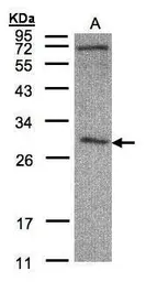 Anti-CLIC3 antibody [N1C3] used in Western Blot (WB). GTX104397