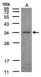 Anti-HAAO antibody [N1C3] used in Western Blot (WB). GTX104402
