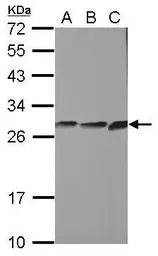 Anti-CYB5R2 antibody [N1C2] used in Western Blot (WB). GTX104417