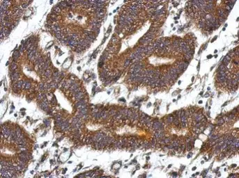 Anti-QDPR antibody used in IHC (Paraffin sections) (IHC-P). GTX104428