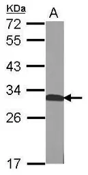 Anti-QDPR antibody used in Western Blot (WB). GTX104428