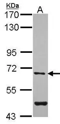 Anti-Arylsulfatase G antibody [N2C2], Internal used in Western Blot (WB). GTX104431