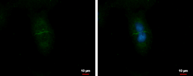 Anti-CD99L2 antibody used in Immunocytochemistry/ Immunofluorescence (ICC/IF). GTX104438