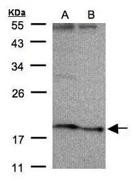 Anti-SCN3B antibody [N1C3] used in Western Blot (WB). GTX104440