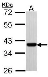 Anti-PAX9 antibody [N2C3] used in Western Blot (WB). GTX104454