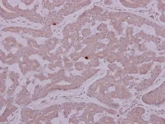 Anti-PCYT2 antibody used in IHC (Paraffin sections) (IHC-P). GTX104462
