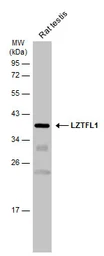 Anti-LZTFL1 antibody [N1C3] used in Western Blot (WB). GTX104469
