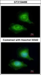 Anti-LZTFL1 antibody [N1C3] used in Immunocytochemistry/ Immunofluorescence (ICC/IF). GTX104469