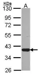 Anti-LZTFL1 antibody [N1C3] used in Western Blot (WB). GTX104469