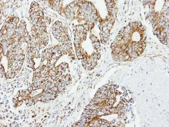 Anti-DCI antibody [N1C3] used in IHC (Paraffin sections) (IHC-P). GTX104473