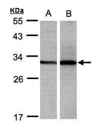 Anti-DCI antibody [N1C3] used in Western Blot (WB). GTX104473