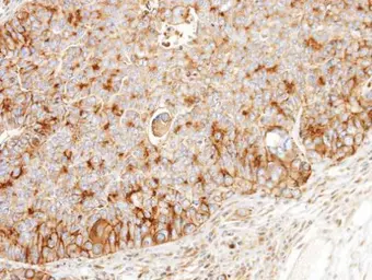 Anti-BCKDK antibody [N2C3] used in IHC (Paraffin sections) (IHC-P). GTX104477