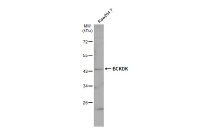 Anti-BCKDK antibody [N2C3] used in Western Blot (WB). GTX104477