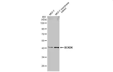 Anti-BCKDK antibody [N2C3] used in Western Blot (WB). GTX104477