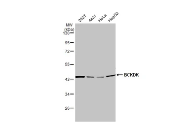 Anti-BCKDK antibody [N2C3] used in Western Blot (WB). GTX104477