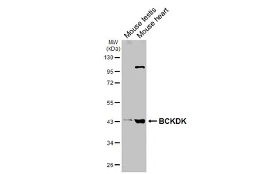 Anti-BCKDK antibody [N2C3] used in Western Blot (WB). GTX104477