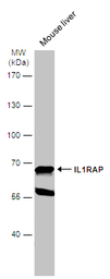 Anti-IL1RAP antibody [N1N3] used in Western Blot (WB). GTX104513