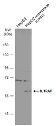 Anti-IL1RAP antibody [N1N3] used in Western Blot (WB). GTX104513