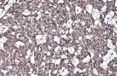 Anti-IL1RAP antibody [N1N3] used in IHC (Paraffin sections) (IHC-P). GTX104513