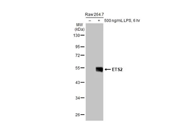 Anti-ETS2 antibody used in Western Blot (WB). GTX104527