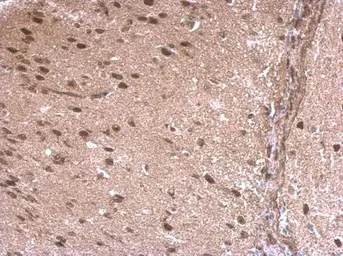 Anti-LDB1 antibody [N2C3] used in IHC (Paraffin sections) (IHC-P). GTX104531