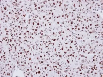 Anti-LDB1 antibody [N2C3] used in IHC (Paraffin sections) (IHC-P). GTX104531