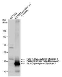 Anti-Glypican 1 antibody [N3C3] used in Western Blot (WB). GTX104557