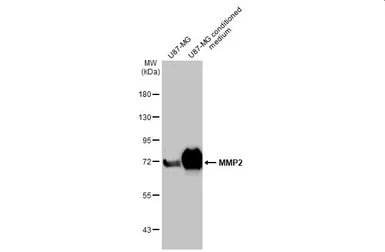 Anti-MMP2 antibody used in Western Blot (WB). GTX104577