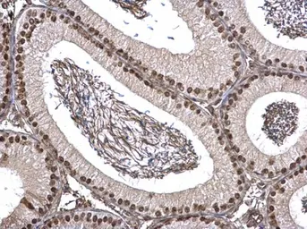 Anti-FUBP1 antibody used in IHC (Paraffin sections) (IHC-P). GTX104579