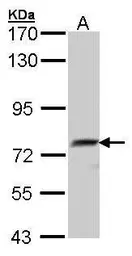 Anti-QSOX1 antibody [N2C2], Internal used in Western Blot (WB). GTX104581