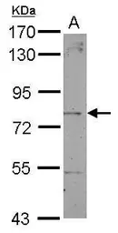 Anti-Dystrobrevin beta antibody used in Western Blot (WB). GTX104584