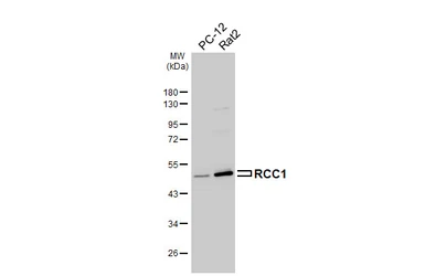 Anti-RCC1 antibody used in Western Blot (WB). GTX104590