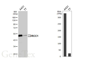 Anti-RCC1 antibody used in Western Blot (WB). GTX104590