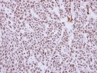 Anti-RCC1 antibody used in IHC (Paraffin sections) (IHC-P). GTX104590