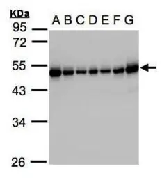 Anti-RCC1 antibody used in Western Blot (WB). GTX104590