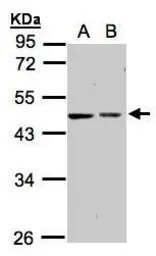 Anti-GALK2 antibody [N1C3] used in Western Blot (WB). GTX104594