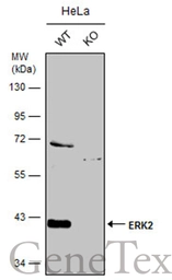 Anti-ERK2 antibody [N1], N-term used in Western Blot (WB). GTX104613