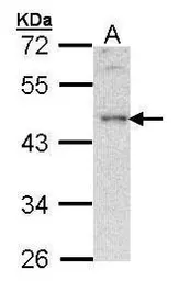 Anti-BLNK antibody [C3], C-term used in Western Blot (WB). GTX104614