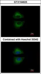 Anti-GRAP antibody [C2C3], C-term used in Immunocytochemistry/ Immunofluorescence (ICC/IF). GTX104623